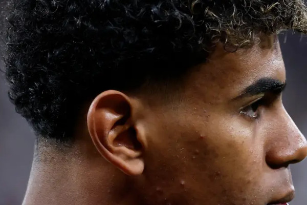 拉明·亚马尔缺阵,巴萨遭遇西甲本赛季第二场失利